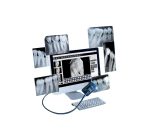 سنسور داخل دهانی ریفاین refine مدل dental sensor2