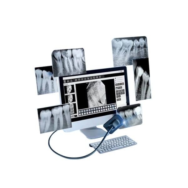 سنسور داخل دهانی ریفاین refine مدل dental sensor2