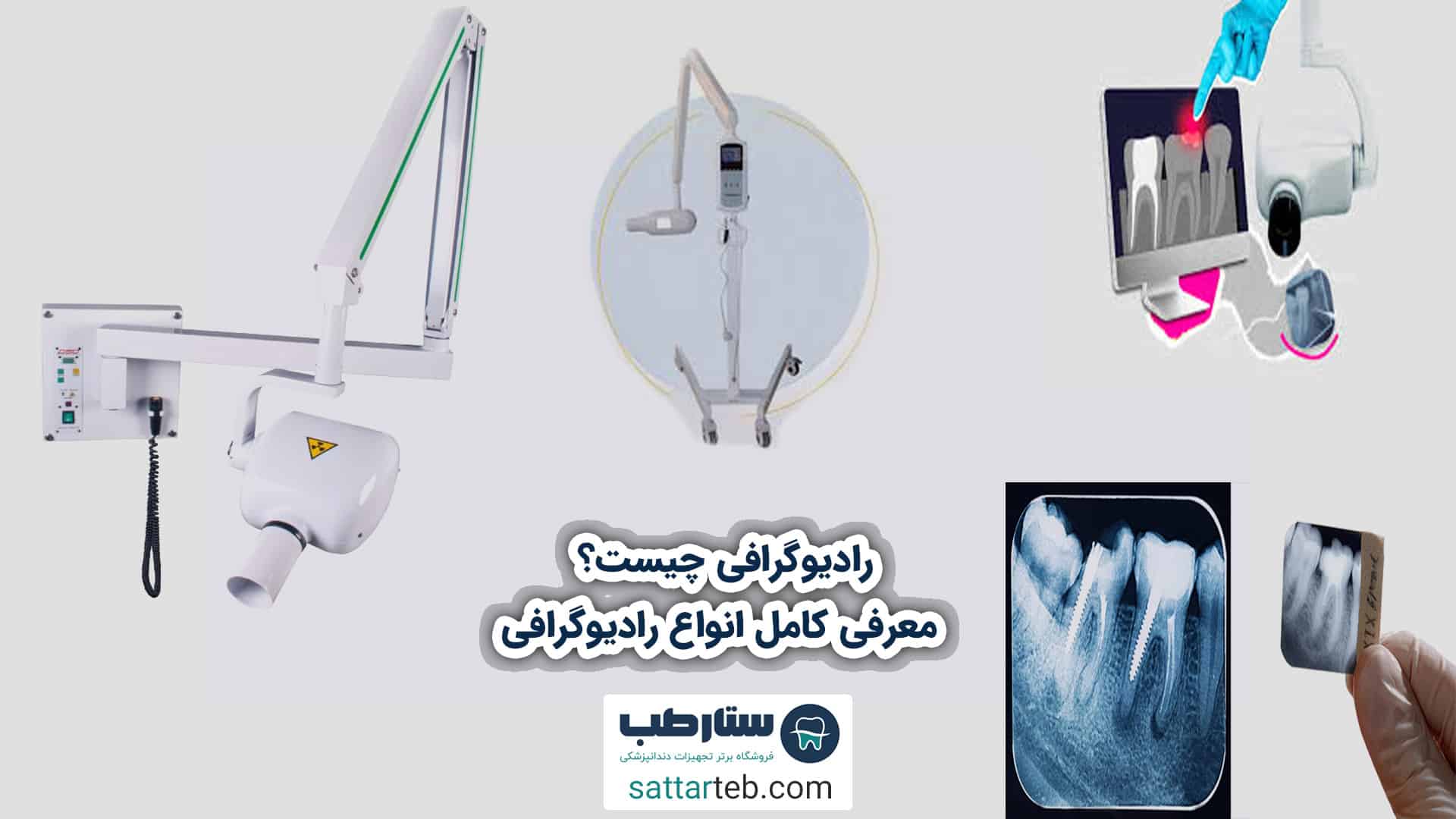 رادیوگرافی چیست؟ معرفی کامل انواع رادیوگرافی 1 رادیوگرافی چیست؟ معرفی کامل انواع رادیوگرافی
