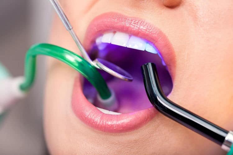 دستگاه ساکشن چیست؟ معرفی انواع ساکشن جراحی دندانپزشکی