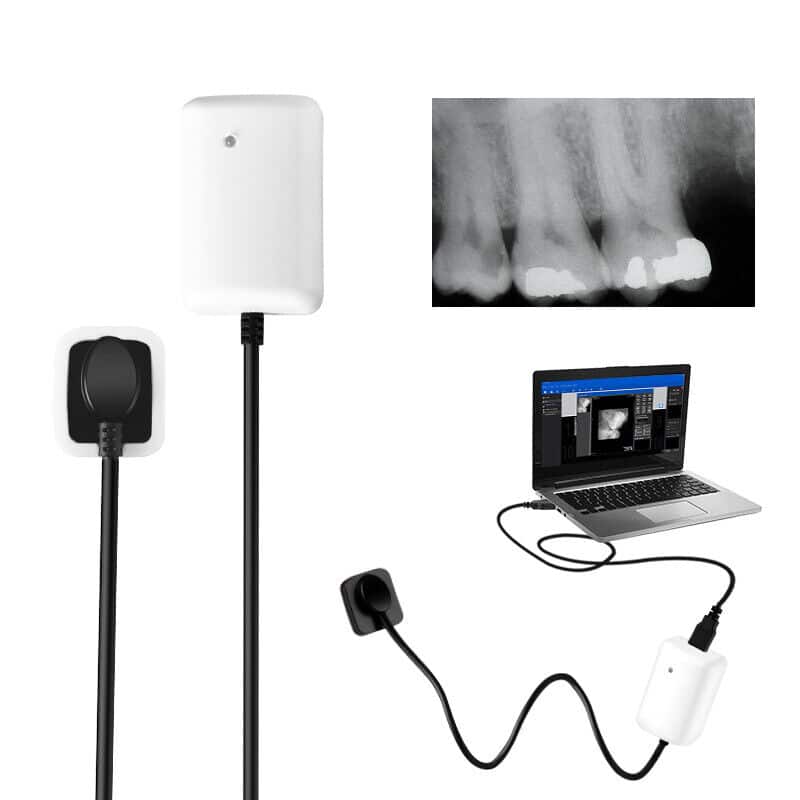 چگونه فناوری آرویجی و فسفر پلیت دقت تشخیص را افزایش میدهد؟ چگونه فناوری آرویجی و فسفر پلیت دقت تشخیص را افزایش میدهد؟